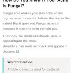 Rekomendasi Skincare Fungal Acne Safe dengan Harga Terjangkau