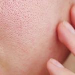 Panduan Lengkap Skincare untuk Mengecilkan Pori-Pori