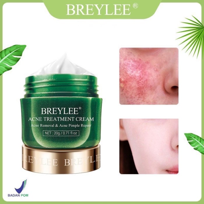 Cek Ingredients Breylee Acne Treatment Cream