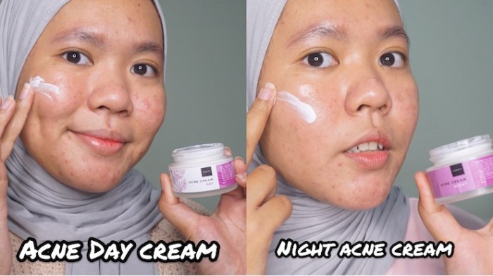 Cek Ingredients Scarlett Acne Cream (Night) terbaru