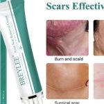 Cek Ingredients Breylee Acne Scar Removal Cream