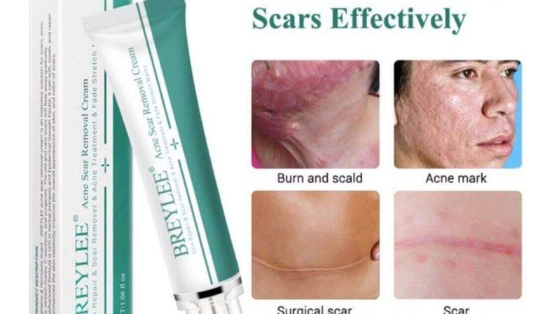 Cek Ingredients Breylee Acne Scar Removal Cream