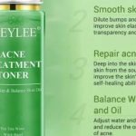 Cek Ingredients Breylee Acne Treatment Toner