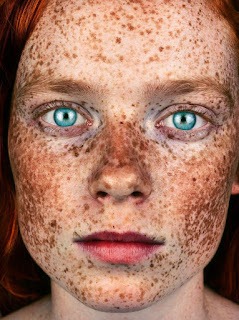 Flek Hitam Bisa Dihilangkan! Mitos atau Fakta?