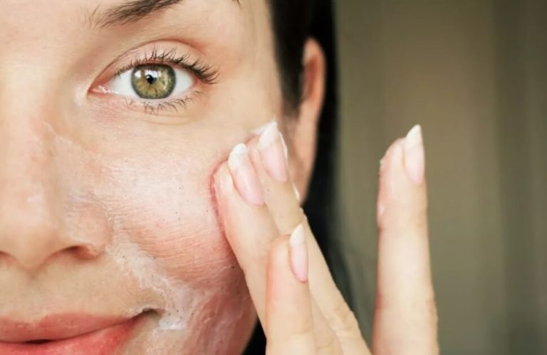 Rekomendasi Pembersih Wajah untuk Kukit Oily-Acne Prone Skin