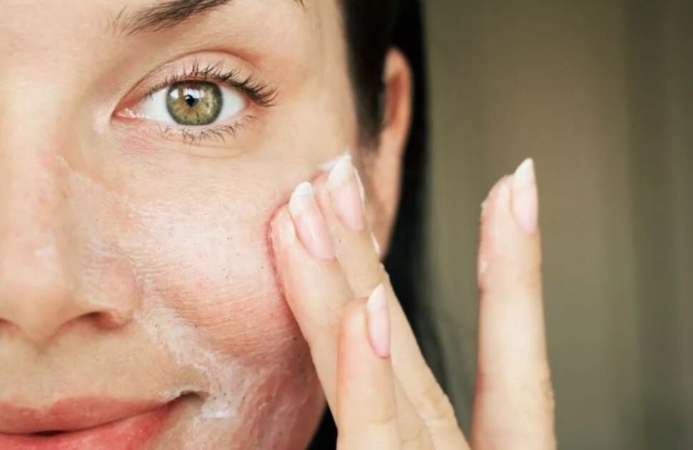 Rekomendasi Pembersih Wajah untuk Kukit Oily-Acne Prone Skin