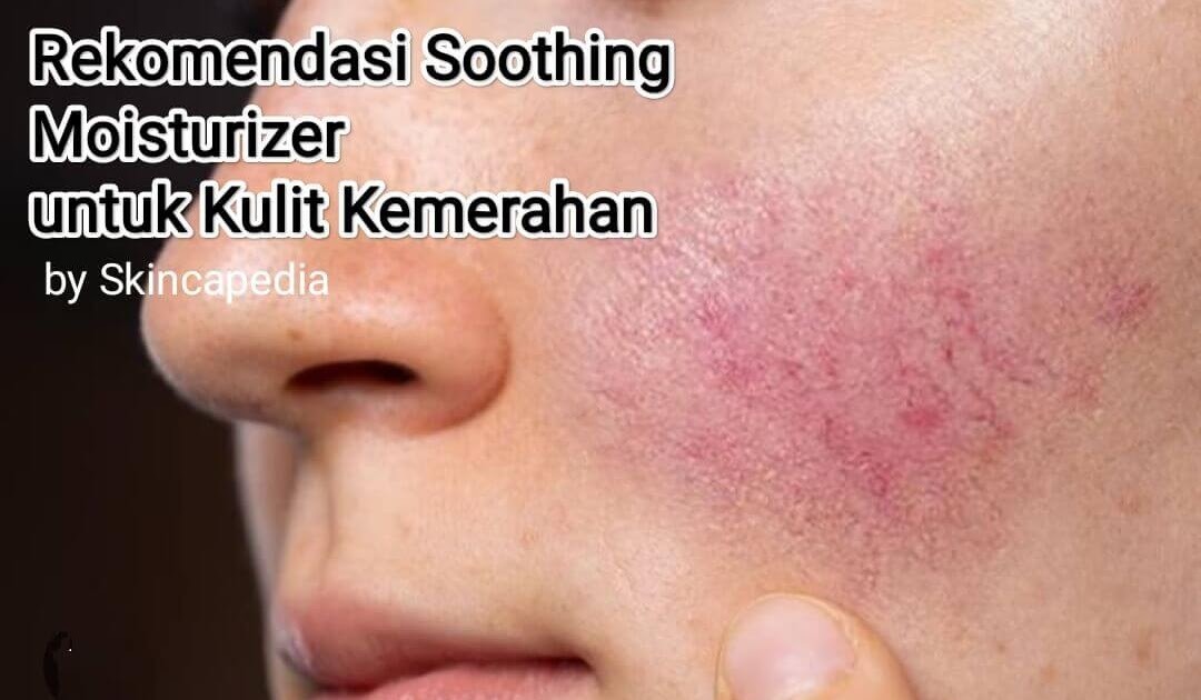12 Rekomendasi Soothing Moisturizer untuk Meredakan Kemerahan
