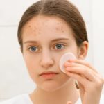 12 Tips Skincare Untuk kulit Remaja