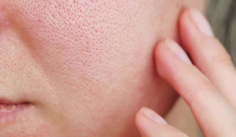 Panduan Lengkap Skincare untuk Mengecilkan Pori-Pori