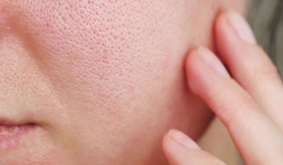 Panduan Lengkap Skincare untuk Mengecilkan Pori-Pori