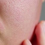 Rekomendasi Produk Skincare untuk Pori-pori Tampak Mengecil