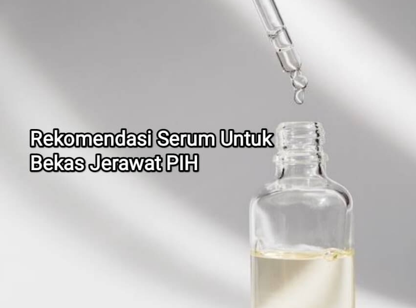 Rekomendasi Serum untuk Mengatasi Bekas Jerawat PIH
