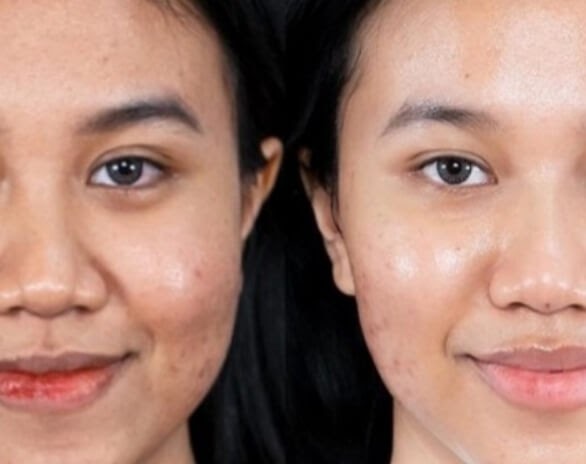 Skincare untuk wajah Glowing bebas kusam