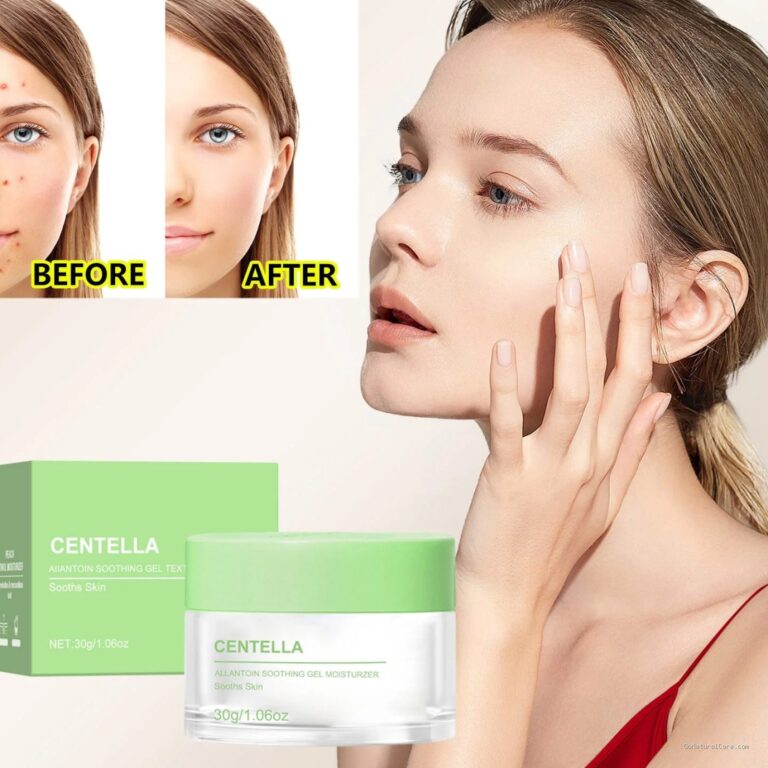 Photo by walmart.com - 7 Rekomendasi Moisturizer Gel Centella Asiatica untuk Kulit Berjerawat