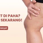 Photo by stindonesia.com - Cara Mencerahkan Selangkangan Hitam Menggunakan Lulur Alami