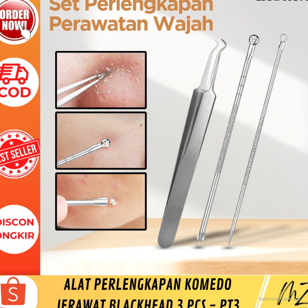 Photo by shopee.co.id - Cara Menghilangkan Komedo Putih dengan Aman Tanpa Dipencet