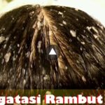 Photo by zhiangzieyie.com - Manfaat Bawang Merah untuk Mengatasi Rambut Rontok dan Cara Pakainya