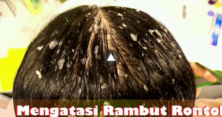 Photo by zhiangzieyie.com - Manfaat Bawang Merah untuk Mengatasi Rambut Rontok dan Cara Pakainya