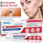 Photo by shopee.co.id - Manfaat dan Cara Menggunakan Salep Calamine untuk Iritasi Kulit