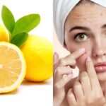Photo by rbtv.disway.id - Manfaat Lemon untuk Mengatasi Kulit Kusam dan Cara Pakainya