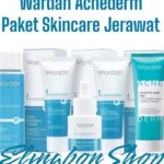 Photo by shopee.co.id - Panduan Memilih Skincare untuk Kulit Berjerawat yang Aman