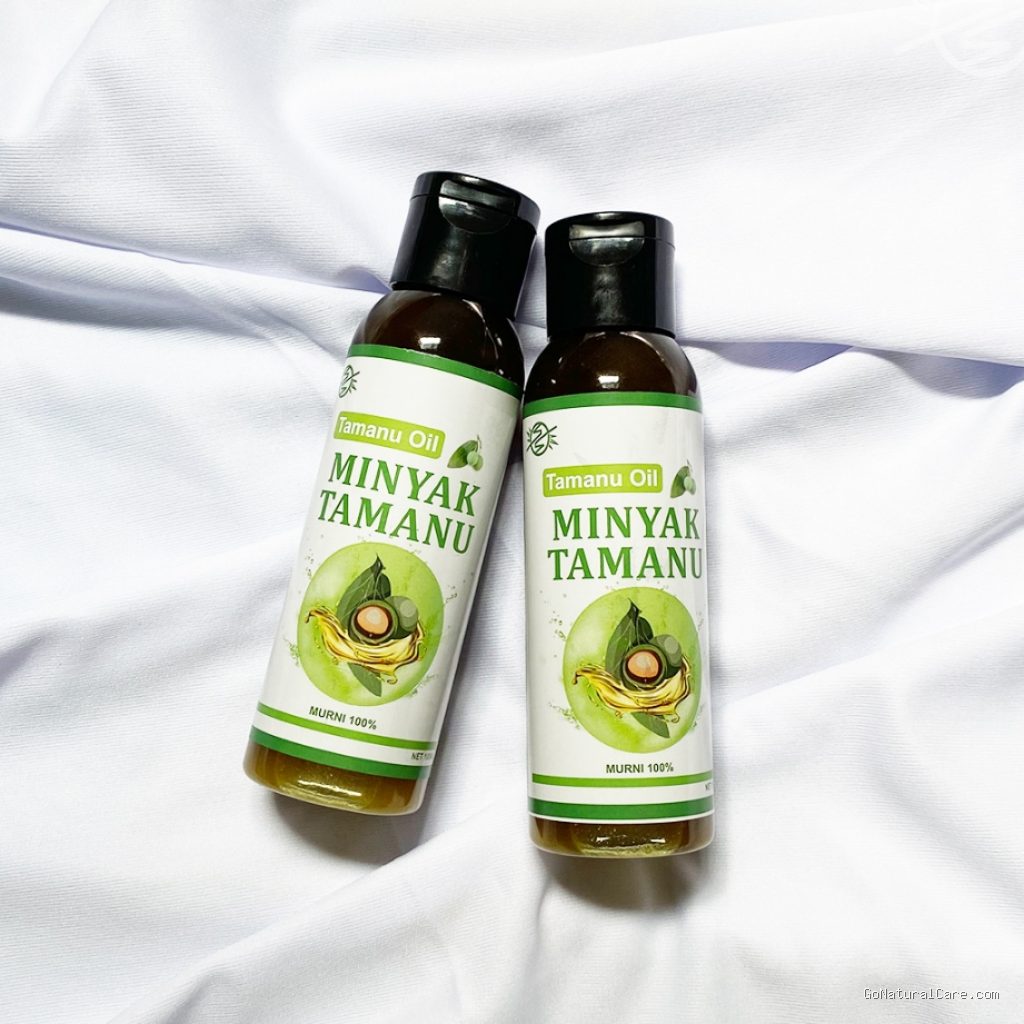 Bolehkah Menggunakan Minyak Tamanu untuk Meredakan Radang Kulit Kepala Gatal