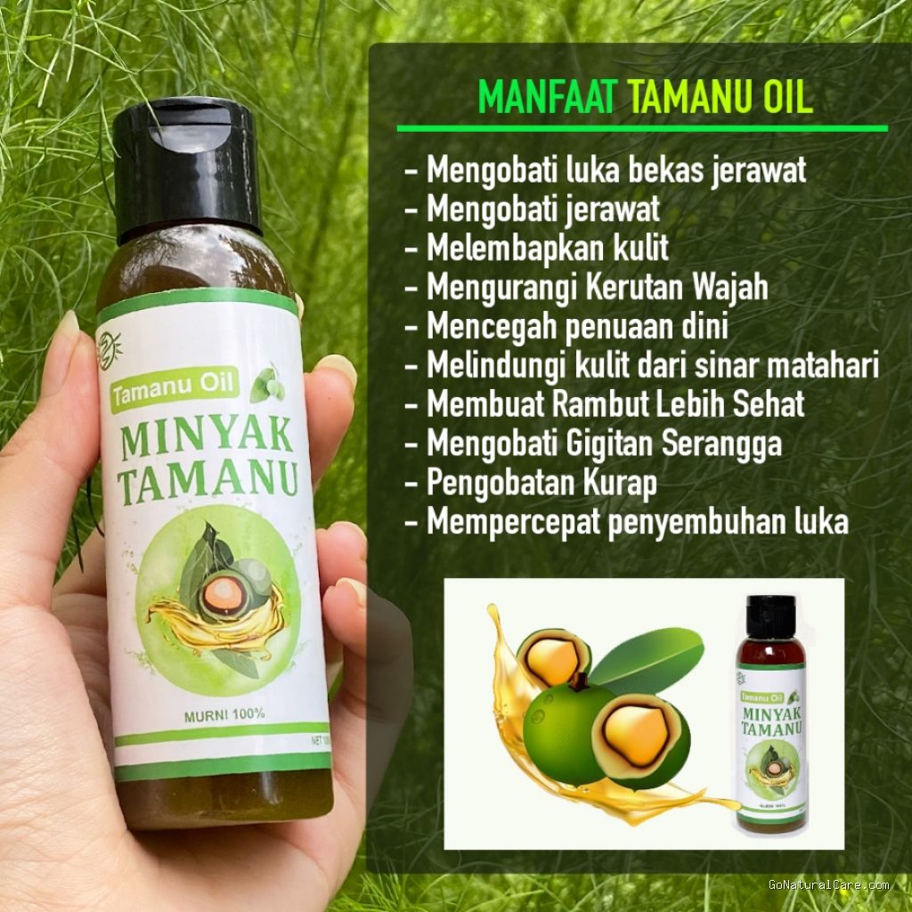 Photo by shopee.co.id - Bolehkah Menggunakan Minyak Tamanu untuk Meredakan Radang Kulit Kepala Gatal