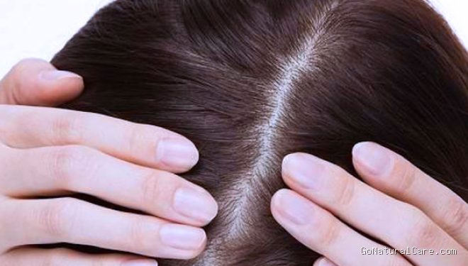 Photo by timesindonesia.co.id - Ciri Folikel Rambut Bersih Bernapas Lega Dilihat dari Warna Kulit Kepala